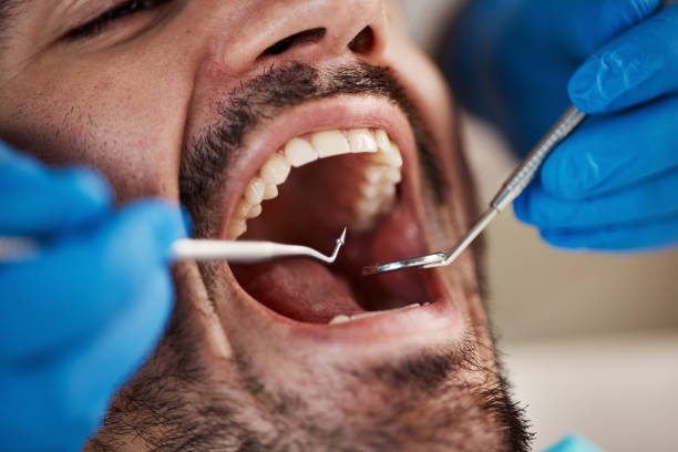Best Emergency Dental Services Near Me  in Massanetta Springs, VA