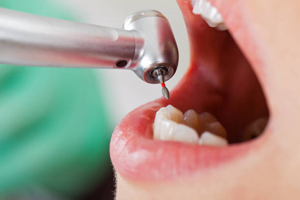 Best Walk-In Dentist Near Me  in Massanetta Springs, VA
